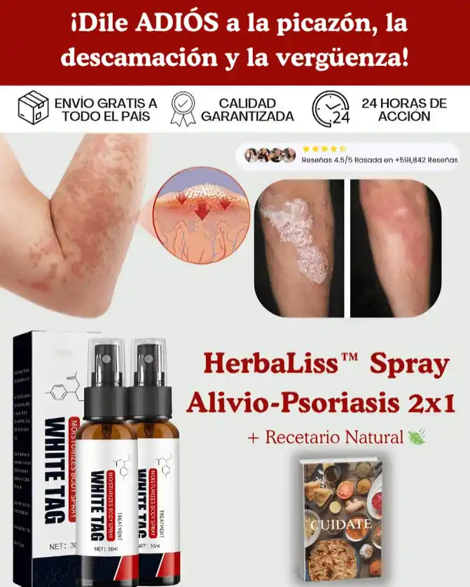 SPRAY PSORIASIS