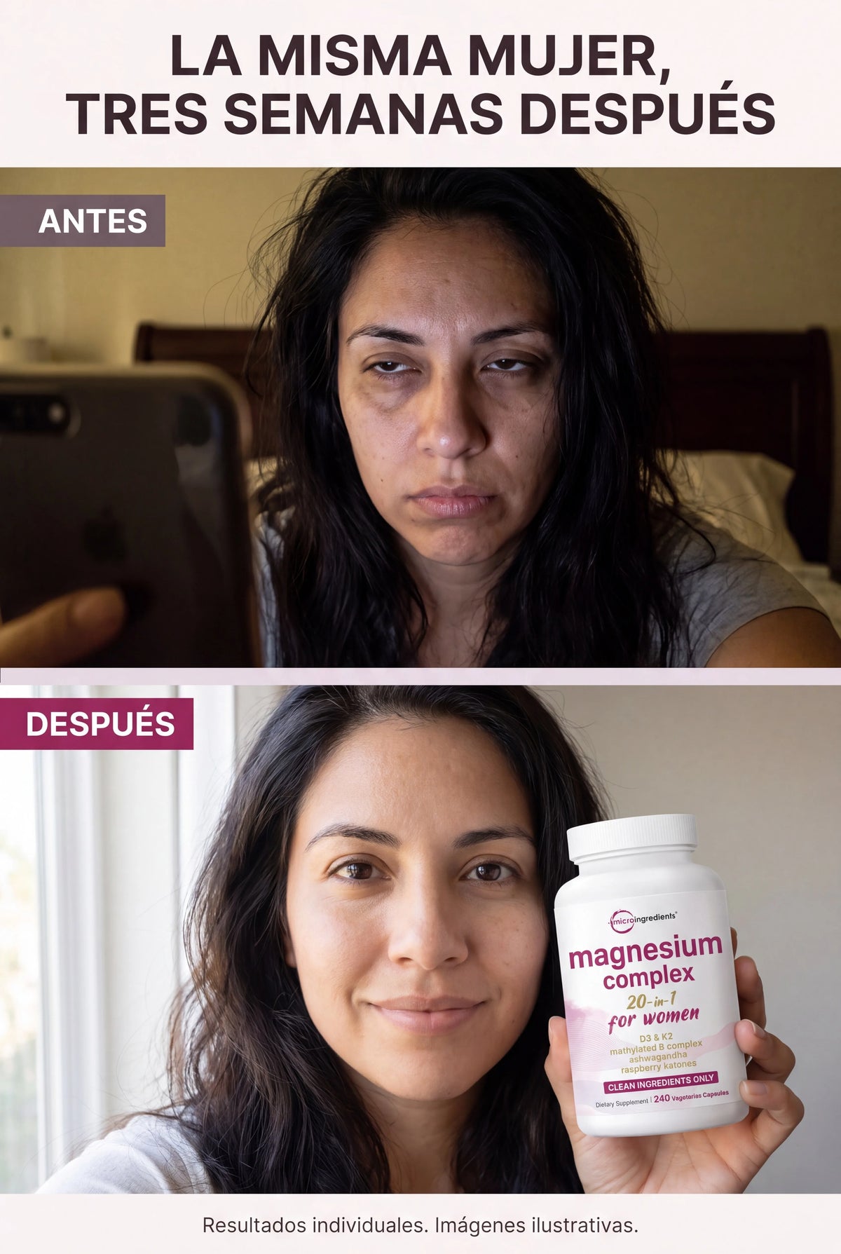 magnesium-complex-women 05_antes_despues